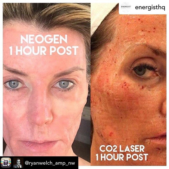 NeoGenPlasma_RSA tweet media