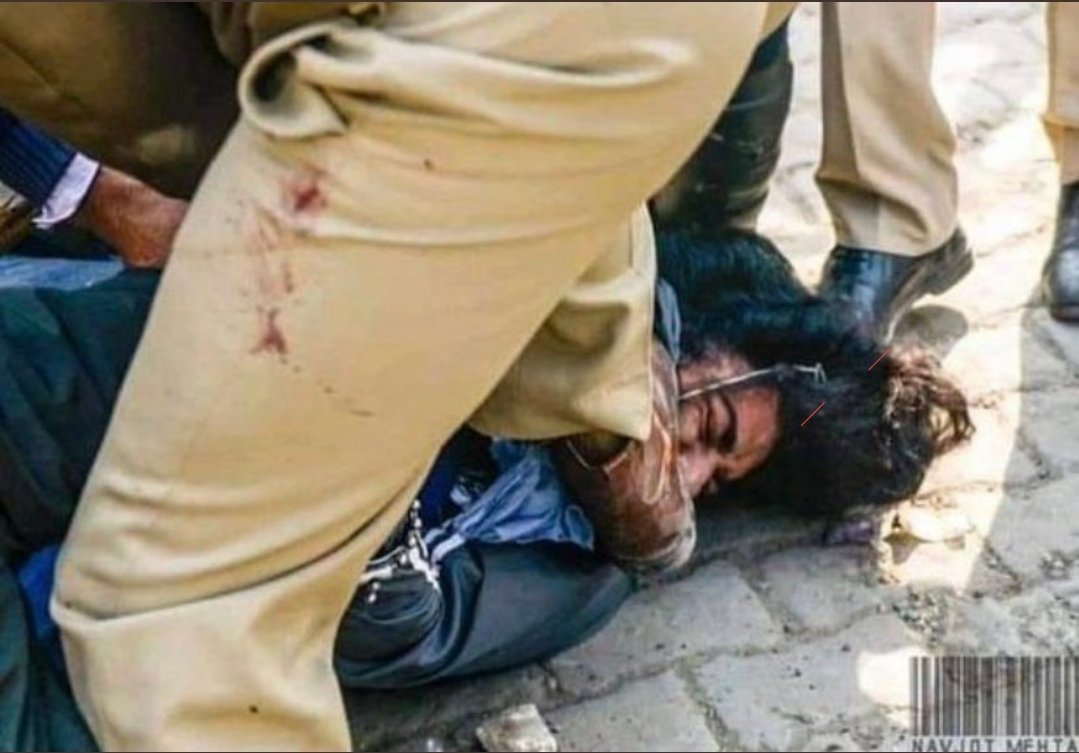 kaurgillv's tweet photo. @ImmortalTech This is what the police have done to those that are defending women and seniors that are protesting. Delhi police have been bringing in govt party workers to attack the farmers. The young man bleeding from his head doesn't own land, he was there just to support
#FarmersProtest https://t.co/vWpfhPzPSP