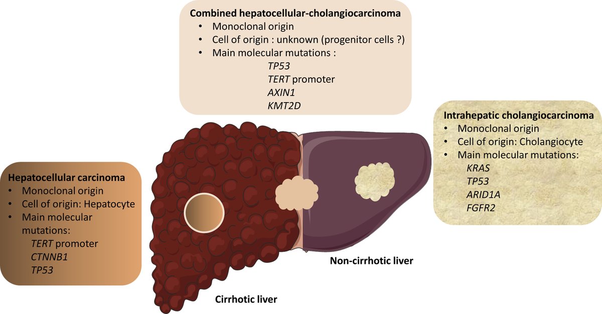 New Review 'Combined hepatocellular-cholangiocarcinoma: An update'

Read at bit.ly/3pP2dyS
#WorldCholangiocarcinomaDay
#livercancer