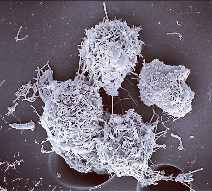 aromicsbiotech's tweet photo. On #CancerWorldDay2021 #WeWill maintian our hope on improving #cancerpatientslife by keep working on the research and development of innovative and safer cures. #WeKeep supporting the fighters, admiring the survivors, honoring the taken and never giving up on finding solutions. https://t.co/w2QNxslXew