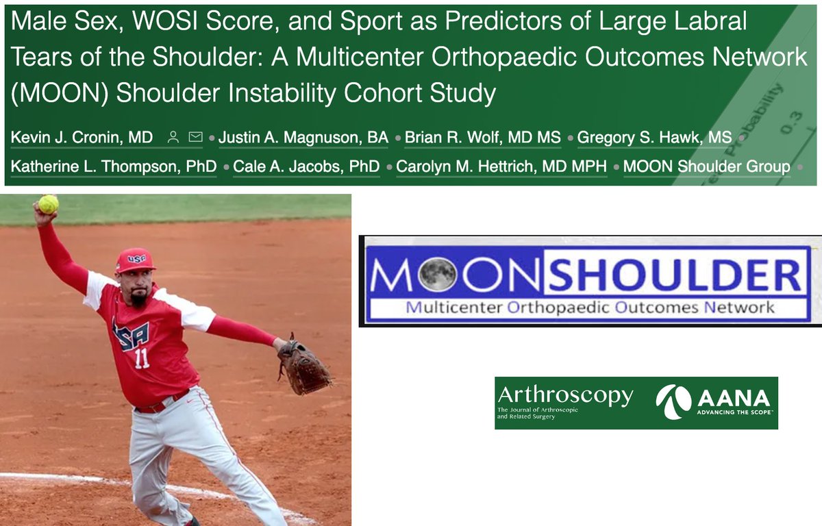 Arthroscopy Journal (@arthroscopyj) on Twitter photo @KevinCroninMD, <a href="/CarolynHettrich/">Carolyn Hettrich MD MPH FAOA</a>, <a href="/MOON_Shoulder/">MOONShoulderGroup</a>, @UK_Ortho reported that male sex, preop WOSI, & participation in racquet sports, softball, skiing, swimming, & golf were associated with large #labraltears at the time of #shouldersurgery #multicenter
ow.ly/A8X050Dnm43 @KevinCroninMD, <a href="/CarolynHettrich/">Carolyn Hettrich MD MPH FAOA</a>, <a href="/MOON_Shoulder/">MOONShoulderGroup</a>, @UK_Ortho reported that male sex, preop WOSI, & participation in racquet sports, softball, skiing, swimming, & golf were associated with large #labraltears at the time of #shouldersurgery #multicenter
ow.ly/A8X050Dnm43