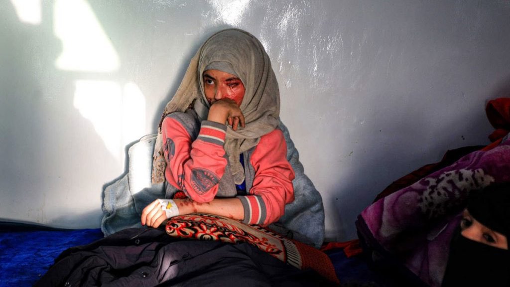 YemeniFeministM's tweet photo. Al-Anoud-a 19 year old Yemeni girl-was forced into marriage at 12 and was abused &amp; treated like a slave. When she asked for a divorce &amp; refused to go back to her husband, he attacked her with acid.

Her now ex-husband is roaming around free. We demand #JusticeForAlAnoud https://t.co/TmoQp1Yry9