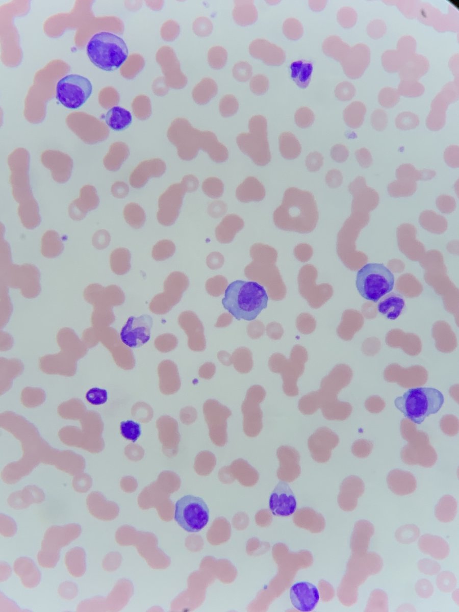 1. One of the questions I get asked a lot is "how do you take such decent microscope photos on your phone?"How do you go from the image on the left to one on the right? Quite simple really... ready for a short thread?