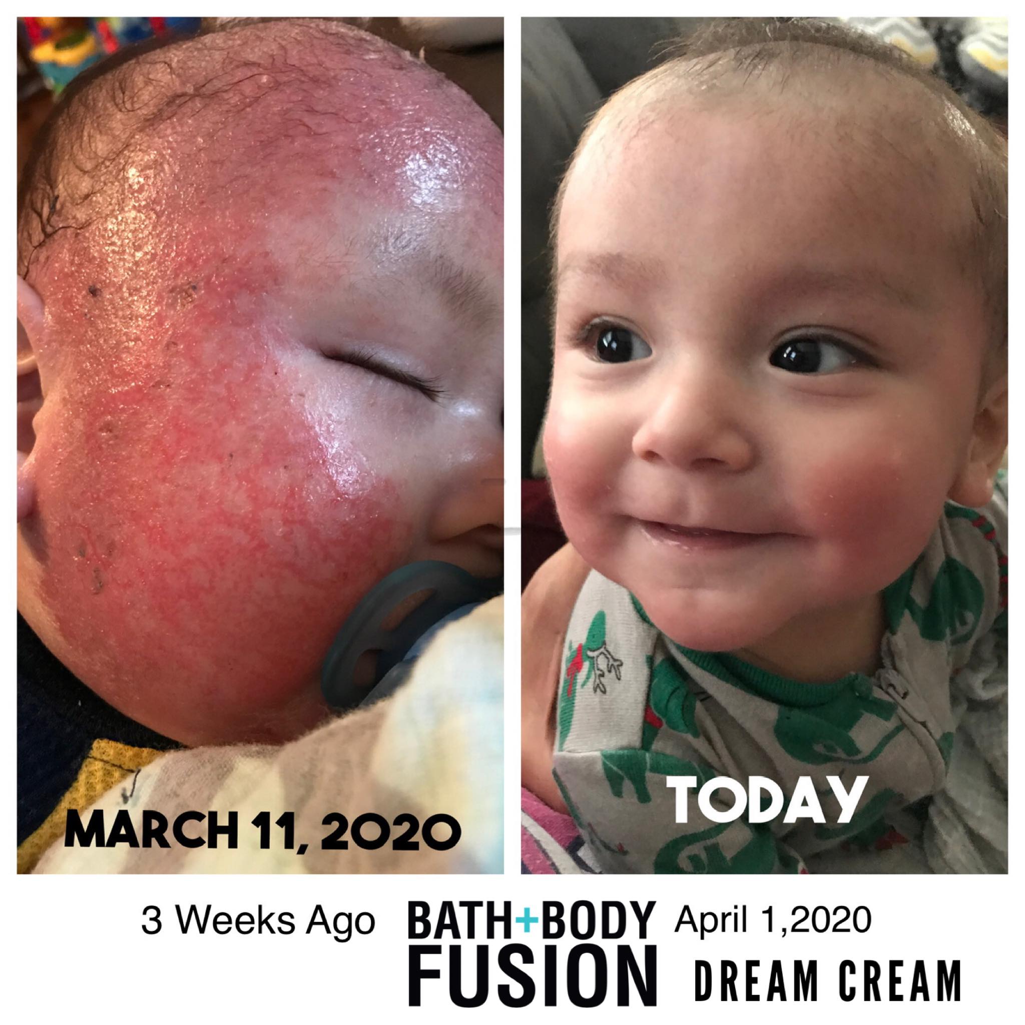 Lush eczema cream baby 2025