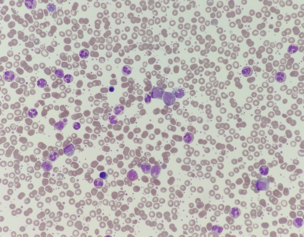 6. Happy taking amazing photos  #underthescope. All those below are taken without a mount. Do you have any images you've taken that you'd like to share? Feel free to do so in the replies!