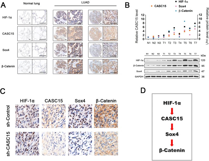 JournalofExper1's tweet image. New research! 

📌#𝐇𝐲𝐩𝐨𝐱𝐢𝐚-𝐬𝐞𝐧𝐬𝐢𝐭𝐢𝐯𝐞 𝐥𝐨𝐧𝐠 𝐧𝐨𝐧𝐜𝐨𝐝𝐢𝐧𝐠 𝐑𝐍𝐀 𝐂𝐀𝐒𝐂𝟏𝟓 promotes 𝐥𝐮𝐧𝐠 𝐭𝐮𝐦𝐨𝐫𝐢𝐠𝐞𝐧𝐞𝐬𝐢𝐬 by 𝐫𝐞𝐠𝐮𝐥𝐚𝐭𝐢𝐧𝐠 the 𝐒𝐎𝐗𝟒/β-𝐜𝐚𝐭𝐞𝐧𝐢𝐧 axis
jeccr.biomedcentral.com/articles/10.11…

#LungCancer
#LongnonCodingRNA
@IREISGufficiale