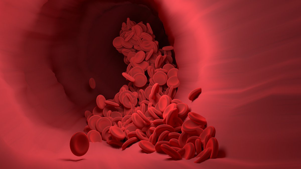 dip_sci's tweet photo. Ever wondered whether non-medical treatments actually work? In this fascinating study (https://t.co/LxtTfb6CoU), the effect of eating billberries on a type of #cancer of the blood called chronic lymphocytic leukemia is explored. 
#WorldCancerDay #worldcancerday2021 #OpenScience https://t.co/JoLwz7tYiw