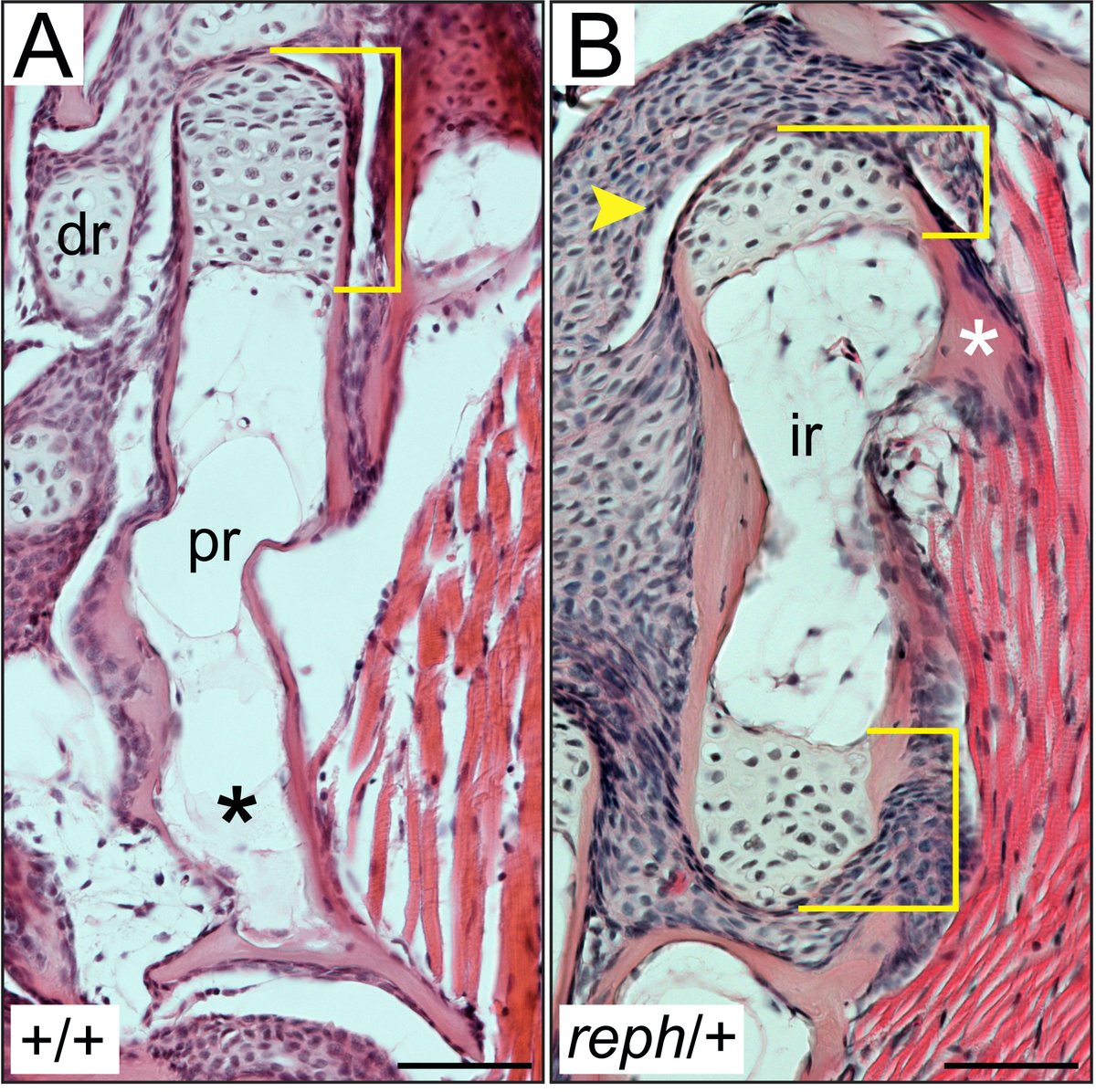 Like distal limb bones, these new bones do not articulate with the shoulder directly. Unexpectedly, the mutant bones are well-form and are integrated into the fin. They make joints with their neighboring bones and are even attached to the fin musculature.