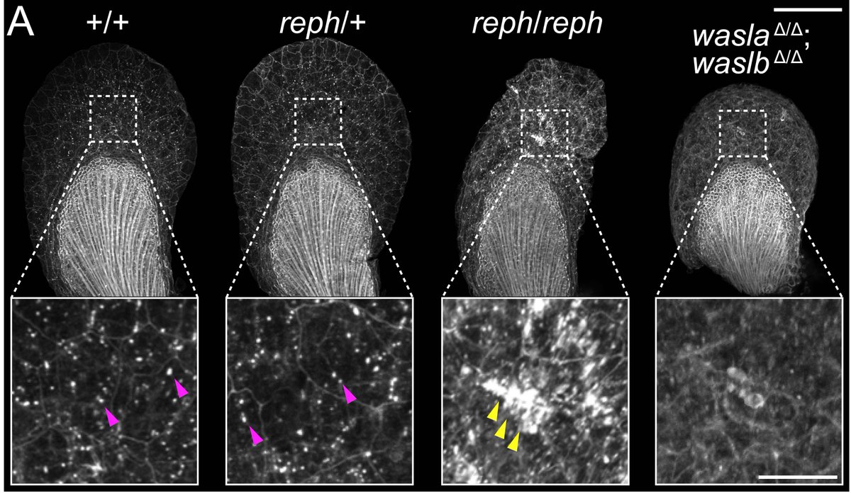 Moreover, we found that vav2 and waslb act together in a pathway. One function of Wasl genes is to promote the formation of F-actin, a component of the cytoskeleton. We found that Wasl mutants exhibit defects in F-actin formation in the fin.