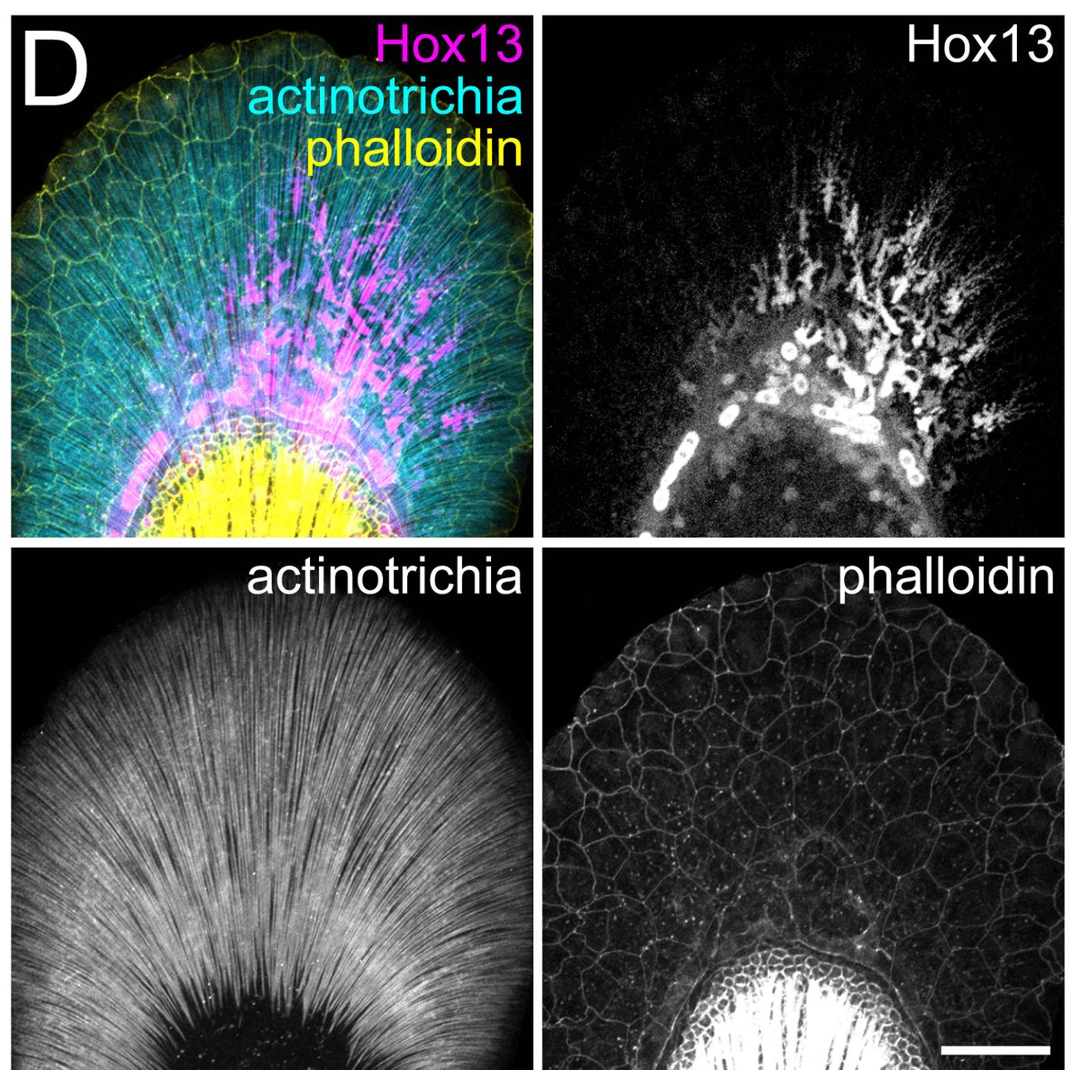 The distribution of F-actin in the fin was interesting, lots of little dots all through the fin fold. We discovered that these dots are located where the support fibers of the fin fold interact with migratory cells that express hox genes.