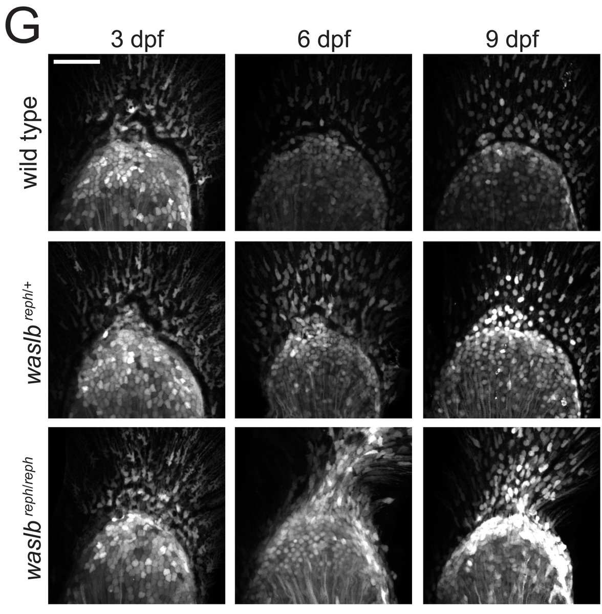 We found that our mutants caused a dramatic increase in Hox11 expression over time when compared to wild type siblings. When we used CRISPR to remove the Hox11 genes from our mutants, and found that this prevented the new bones from forming. The bones need Hox11 to form.