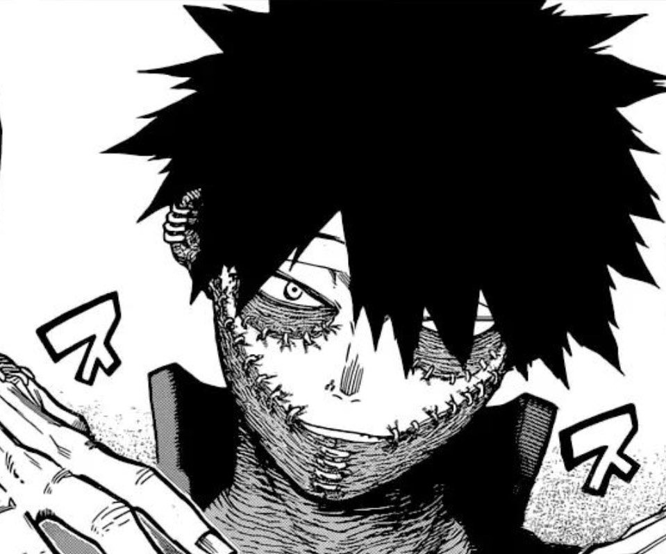 Shouto's bandages are around the same places as Dabi's scars 