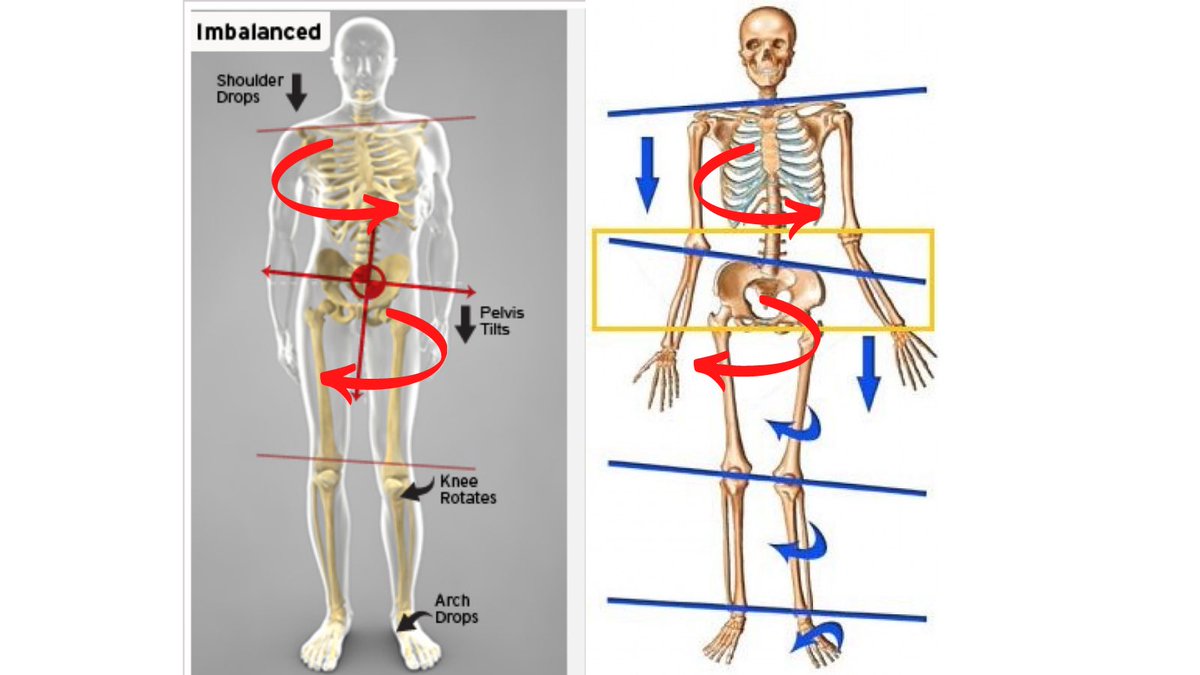 How hip position influences trunk orientation

The body seeks a neutral center of mass that faces forward.

If the hips are oriented one way (i.e. to the right), the trunk tends to counter-rotate in the opposite direction (the left) in an attempt to “straighten” itself out.