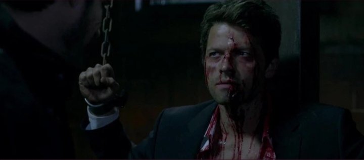 Tw//bloodOnce again, no one should look this good with blood