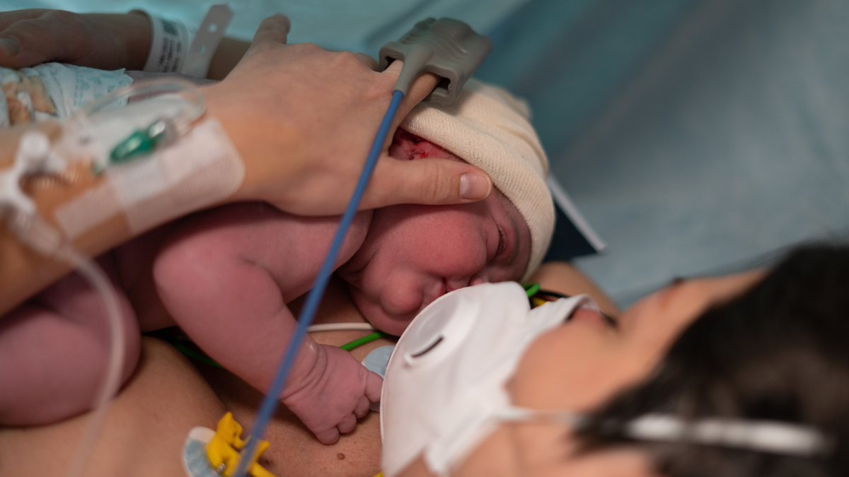 NEJMClinician's tweet image. #COVID19 in #Pregnancy linked to many adverse maternal outcomes: jwat.ch/3oTp9Me