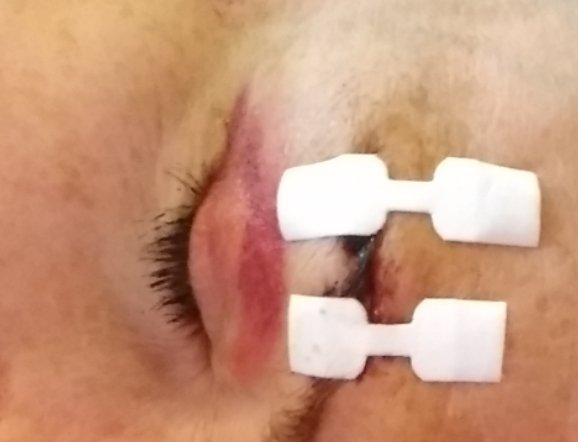 EmberReine's tweet photo. Down Domme.  Split eyebrow before/after butterflies and bruised knee.  I NEED pampering.  $end to make me feel better. @RT4BOSS @SubmitLoser @rt4_sex @FootObsession_ https://t.co/GAo4gFvEBQ