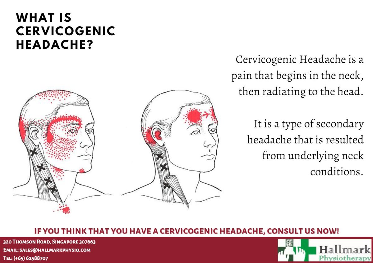 HallmarkPhysio's tweet image. Say no to your Cervicogenic Headaches! Come consult us!
