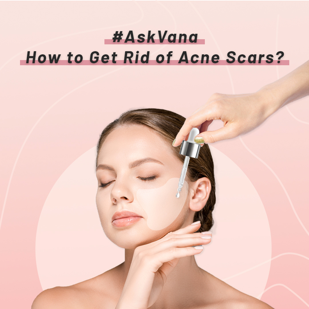 stylevana_sv's tweet photo. You ASKED, we ANSWERED 👆🏻😉 For those who's looking for a chance to break up with your dark spots and acne scars? Read all about our rescue plan at our #VanaBlog ASAP (and thank us later) 🙌🏻💆🏻‍♀️

READ HERE: https://t.co/fKybHSBazo

#stylevana #kbeauty #acneproneskin #acnescar