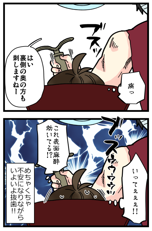親知らずを抜いた話、その3です。
関西で通ってた歯科医では表面麻酔めっちゃ効いてて麻酔が痛いってことなかったから、かなり油断してました? 