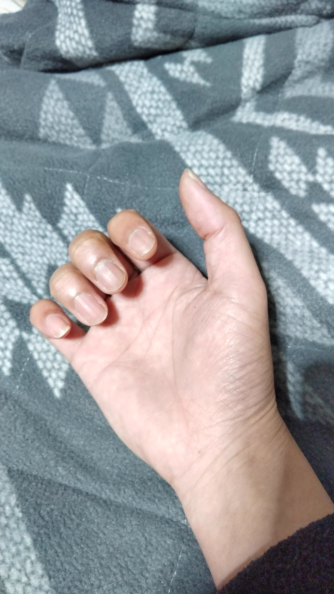 @9y2NM7zuz24sVfn @eKPtFFyuUs4L2nJ ｢異様に指が長い｣と人々から驚かれる４０歳未満の男の手です。
ちなみに製造業の現場職ですので💧 