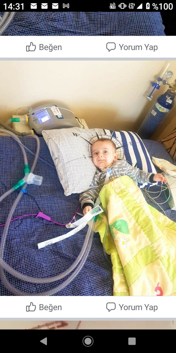Sakarya'da EYMEN bebek yardım bekliyor 
Annesinin göz yaşlarını gördük
Arkadaşlar sizlerden ricamız EYMENe destek olmanız !!  Eymen ve Diğer SMA hastası çocuklar için ACİL çözüm VE tedavi BEKLİYORUZ! #EYTSGM #saglikbakanligi #AKParti  #chp #RTErdogan