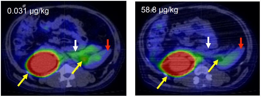 ADA_Pubs's tweet photo. 📰 New Study Published:
"Drug Occupancy Assessment at the Glucose-Dependent Insulinotropic Polypeptide (GIP) Receptor by Positron Emission Tomography"

➡️ Read now (online ahead of print):
https://t.co/dAlt4rD6z8 https://t.co/fRnw0XW1LB