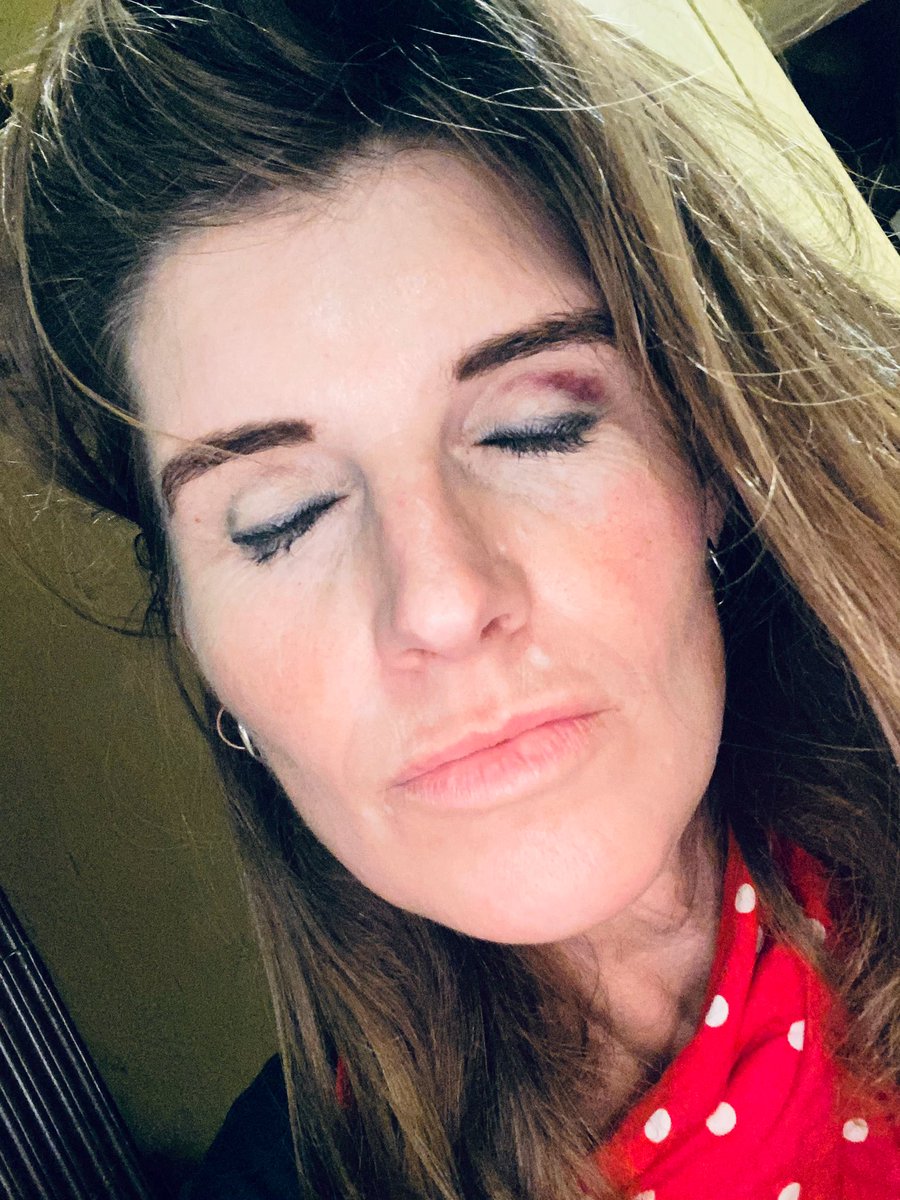 YorkshireShepherdess tweet media