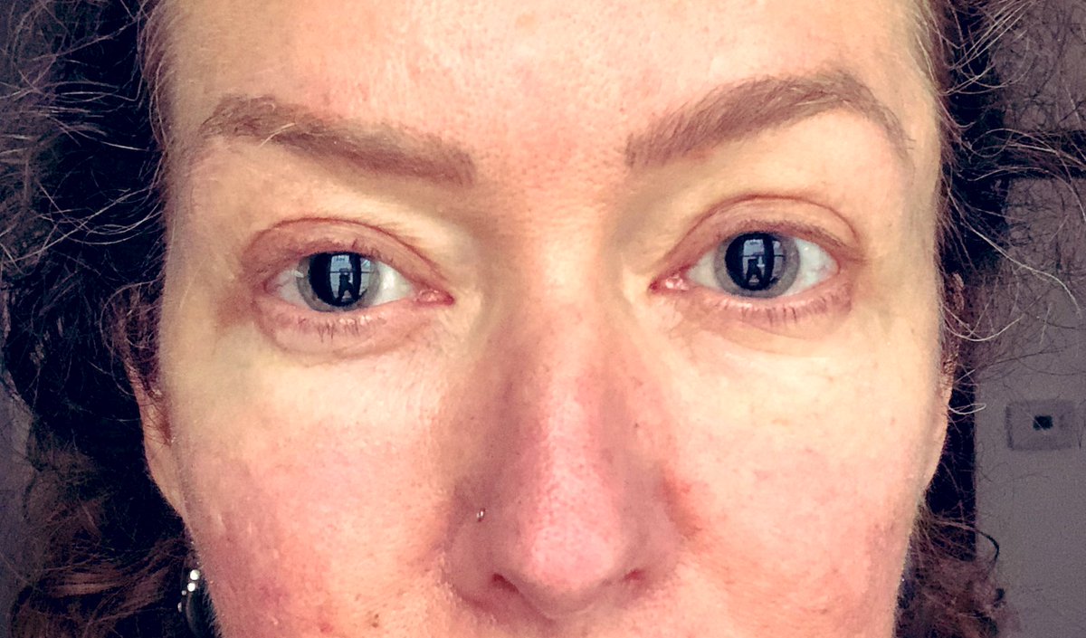 EmmaONeillVO's tweet photo. Sure I can record today! Just point me in the general direction of the script..... 🤪
#eyetest #visualhealth #vo #pupildilation #voiceactor #readers #opthalmology https://t.co/b6RjBWWdxG