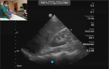 SonoInternist's tweet photo. Check out this *unique opportunity* from @ACPinternists!  https://t.co/tNbaSEemGY
Took an intro to #pocus course but struggling to become proficient?  Get monthly virtual mentorship+remote guidance+image feedback from awesome instructors to help you master core #impocus skills!😎 https://t.co/zDyT1XcFla