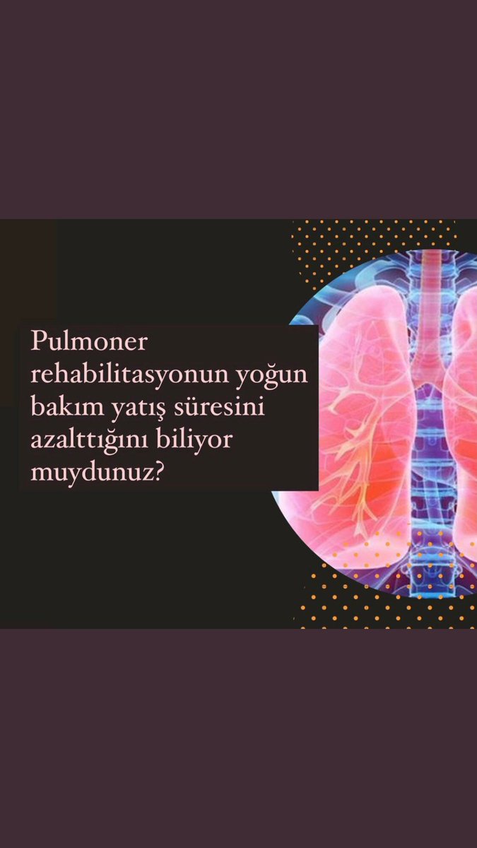 fzt_5's tweet photo. #Covid19daFizyoterapistŞart
HASTALAR SIRA FİZYOTERAPİSTLER ATAMA BEKLİYOR 
@RTErdogan 
@drfahrettinkoca 
@TFD1969 https://t.co/HQAGWPZPyE