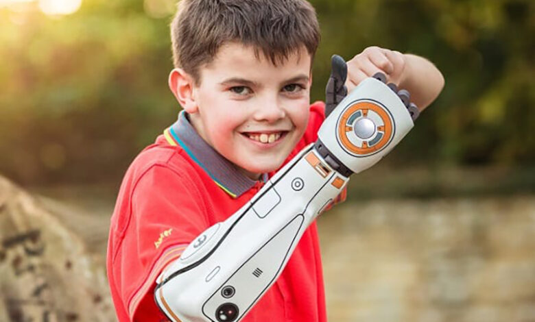 DHorizons's tweet photo. https://t.co/Tqb0h7Irhi
We’ve partnered with Bionics for Everyone to bring you everything you need to know about #bionic arms and hands, including detailed descriptions of the current #technologies and the latest #research.
#BionicLimbs
#Disability
#Inclusion
@BionicsEveryone https://t.co/wdYFatoXpj