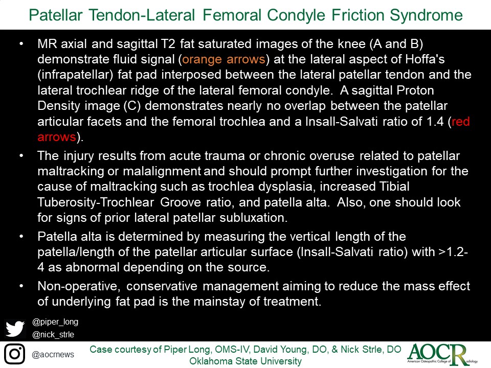 22yo F presents w/ chief complaint of anterior knee pain

Swipe to view complete case
Courtesy @piper_long, David Young, DO &amp; @nick_strle | Oklahoma State Univ

#radiology #AOCR #MedEd #RadRes #RadFellow #radiologist #radiologylearning #radiologylife #caseoftheweek