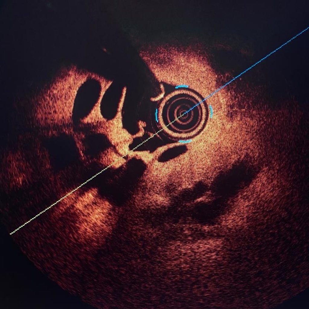 Jose Luis tweet media