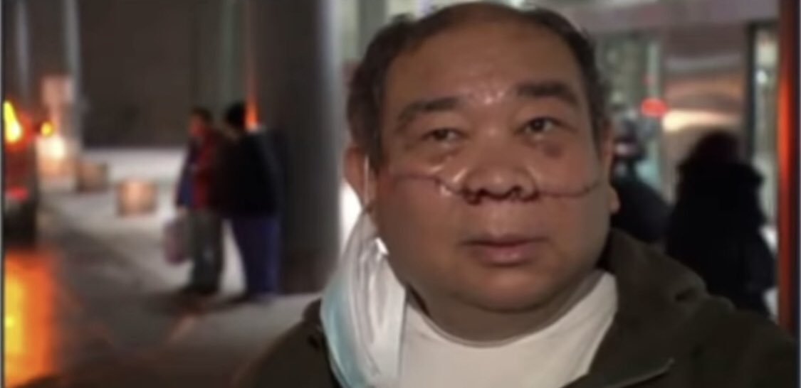 jdschang's tweet photo. Another attack. A Filipino man was slashed from ear to ear on the subway. Asian American elders are being targeted. These are not isolated incidents. We need to speak up and raise awareness that this has been happening and NEEDS TO STOP.

https://t.co/5jOcdm6C01 https://t.co/PKvMHLTZoj