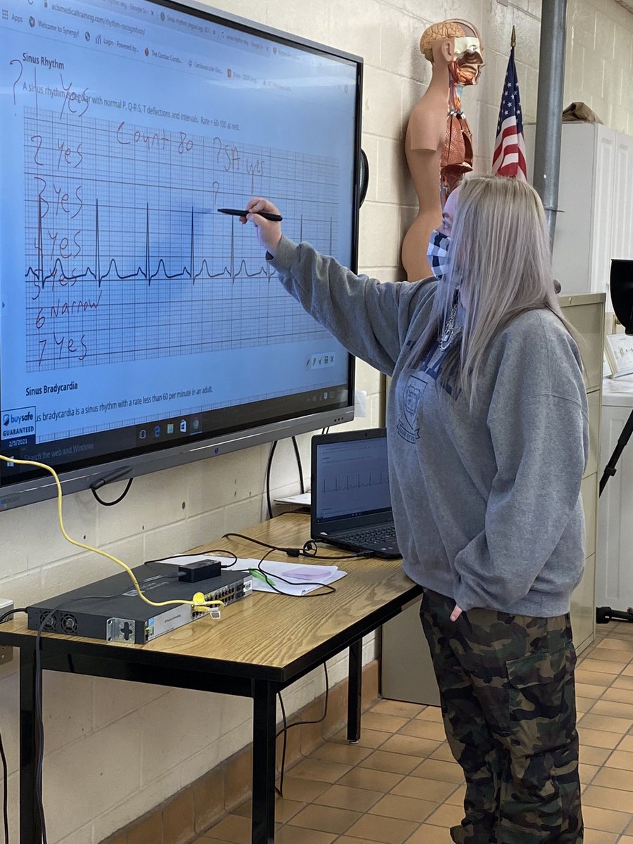 amygwatson18's tweet image. EKGs are hard!  But my students are learning how to find the normal and differentiate the abnormal based on #7questions.  Couldn’t be prouder!
#FuturesBright #ChaseThePWave #MarchItOut