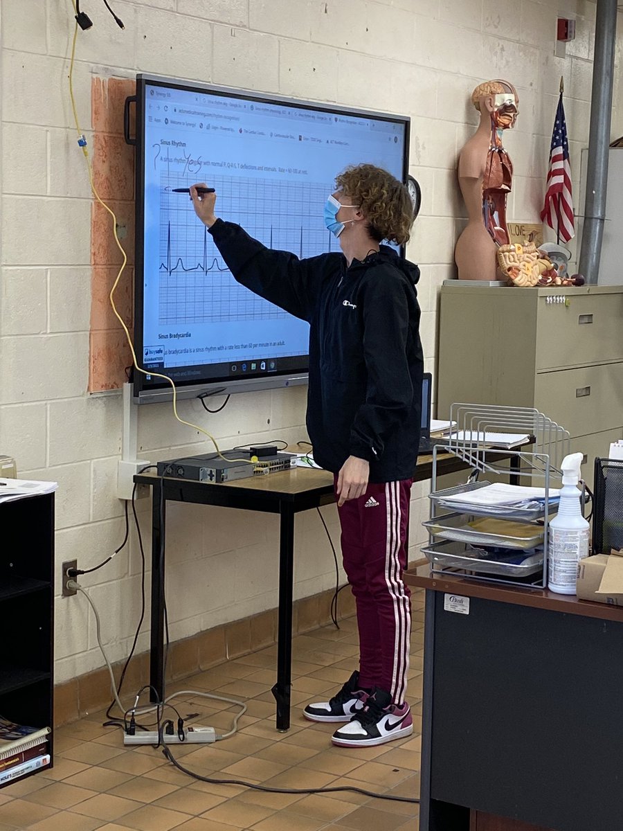 amygwatson18's tweet image. EKGs are hard!  But my students are learning how to find the normal and differentiate the abnormal based on #7questions.  Couldn’t be prouder!
#FuturesBright #ChaseThePWave #MarchItOut