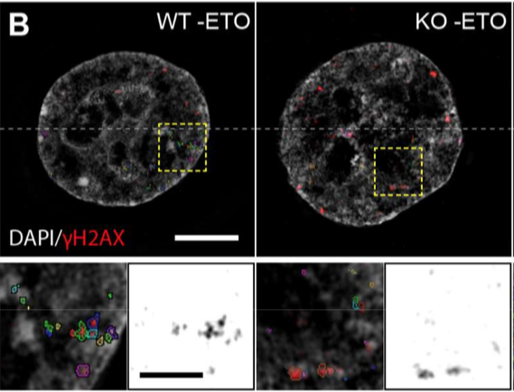 preLights (@prelights) on Twitter photo FUSzy ways of DNA damage response. prelights.biologists.com/highlights/fus…
By preLighters <a href="/ram_ssrc/">Sree Rama Chaitanya</a> and <a href="/GiuseppinaDAle9/">Giuseppina D'Alessandro</a> on preprint from <a href="/levonebr/">Brunno Rocha Levone</a> et al. with author's response FUSzy ways of DNA damage response. prelights.biologists.com/highlights/fus…
By preLighters <a href="/ram_ssrc/">Sree Rama Chaitanya</a> and <a href="/GiuseppinaDAle9/">Giuseppina D'Alessandro</a> on preprint from <a href="/levonebr/">Brunno Rocha Levone</a> et al. with author's response