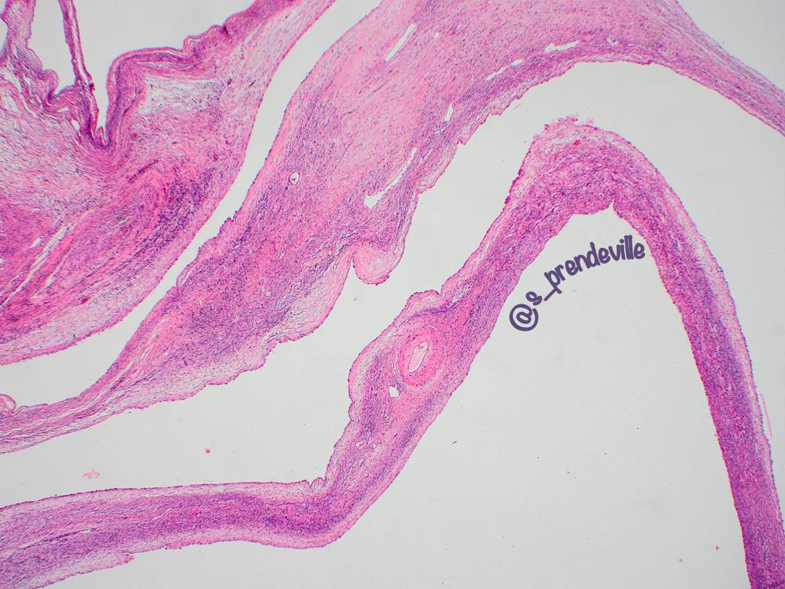 Susan Prendeville tweet media