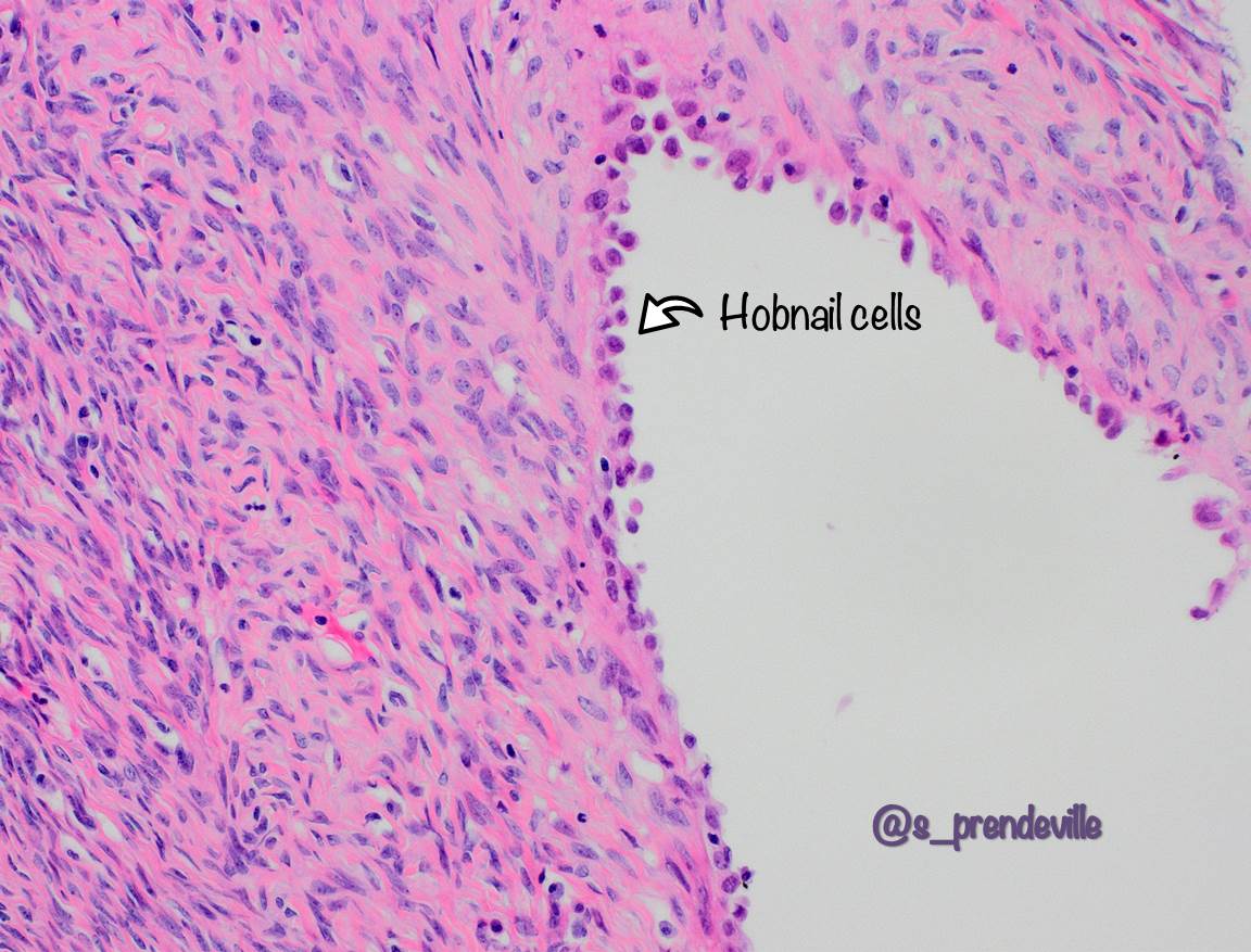 Susan Prendeville tweet media