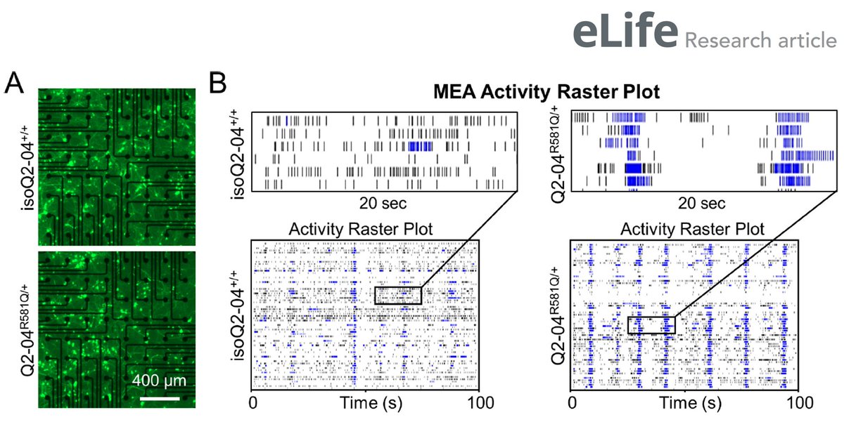 Axion BioSystems (@axionbio1) on Twitter photo Researchers <a href="/NorthwesternU/">Northwestern</a> used the #MaestroPro MEA system to study an #iPSC model of neonatal epileptic encephalopathy. The authors conclude that targeting dyshomeostatically altered ion currents might offer a therapeutic strategy:
axionbiosystems.com/resources/publ…
#StemCell #Epilepsy Researchers <a href="/NorthwesternU/">Northwestern</a> used the #MaestroPro MEA system to study an #iPSC model of neonatal epileptic encephalopathy. The authors conclude that targeting dyshomeostatically altered ion currents might offer a therapeutic strategy:
axionbiosystems.com/resources/publ…
#StemCell #Epilepsy