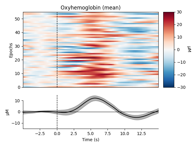 rob__luke's tweet photo. Check out the new MNE-NIRS website https://t.co/nKSPySsDPE with tutorials on GLM, waveform, group level analysis, artefact rejection etc. It makes #fNIRS #reproducibleresearch easy with @mne_news. Tutorials are auto tested with every code update to ensure your scripts never break https://t.co/pRYmjz48up