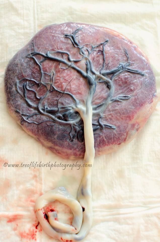 chrisreymond89's tweet photo. The Tree of life ππ€π€πΎππΎ #MotherUniverse #DevineGoddess #BlackWoman #WombMan #giveroflife https://t.co/xsW4lKt0RS