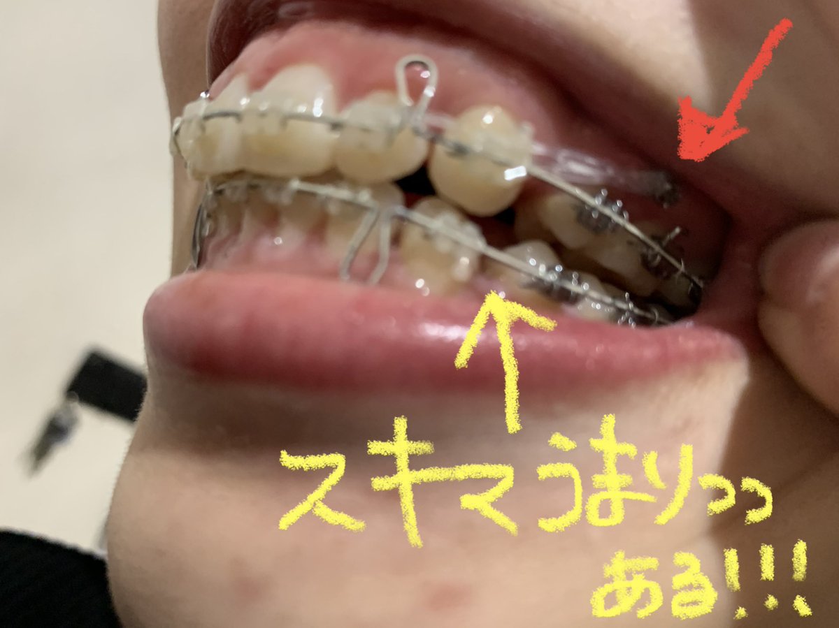 ガミースマイル Hashtag V Twitter ガミースマイル Hashtag V Twitter