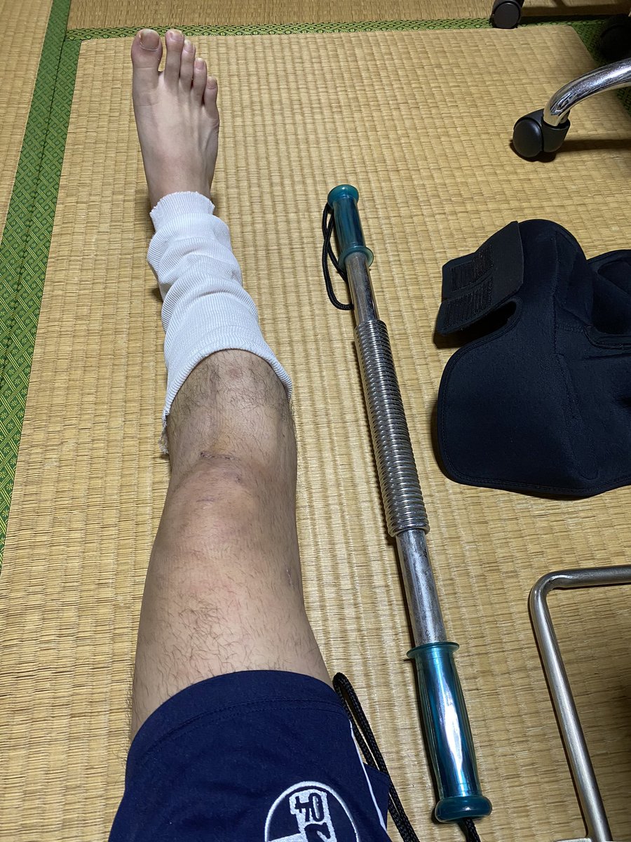 Shogo ストリートサッカー Gioverta On Twitter 完治に向けて Vol 16 内転筋に力が入りづらい 爪先を立てた時は全然 爪先を外に開いた時は少し可能性感じる って感じ 爪先を立てた時は力が入らないどころか膝裏の外側の筋が少し引っ張られるような痛さ 前十字靭帯