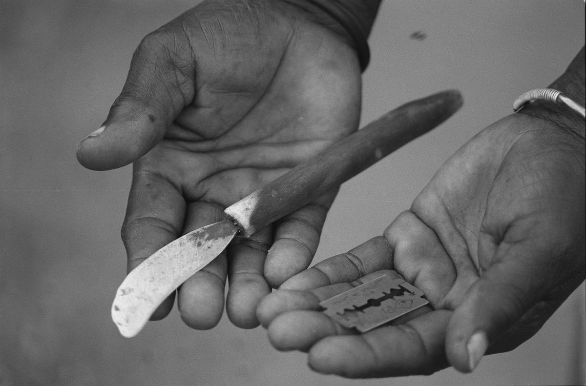 Día Internacional de tolerancia Cero con la mutilación genital femenina. 
Cada año, 3 millones de niñas son sometidas a la tortura
de la mutilación genital. La ONU estima que en el mundo hay al menos 200 millones de niñas y mujeres cortadas.
#BarbariePatriarcal