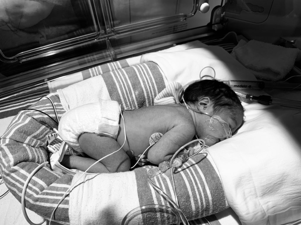 dijoneeee_'s tweet photo. On February 2,2021 3:15am I gave birth to our beautiful daughter, Aubrey Amiri Flowers🌹Although she wasn’t expected to come so early,she had other plans on meeting her mommy&amp;daddy on her own time! I feel so complete &amp; I still can’t believe I get to be ur mommy! I❤️U Princess😘💕 https://t.co/SeWVVDFBj7