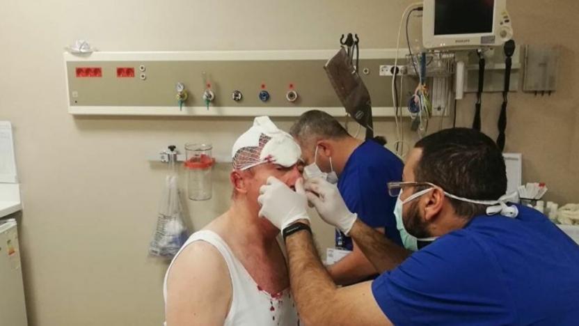 Selçuk Özdağ’a saldırı sonrasında dosyadan sorumlu başsavcı vekili tehdit edildi, ardından soruşturma savcısı değişti ve Ülkü Ocakları yöneticilerine takipsizlik çıktı
 ankaragazetecisi.com/2021/02/06/sel…