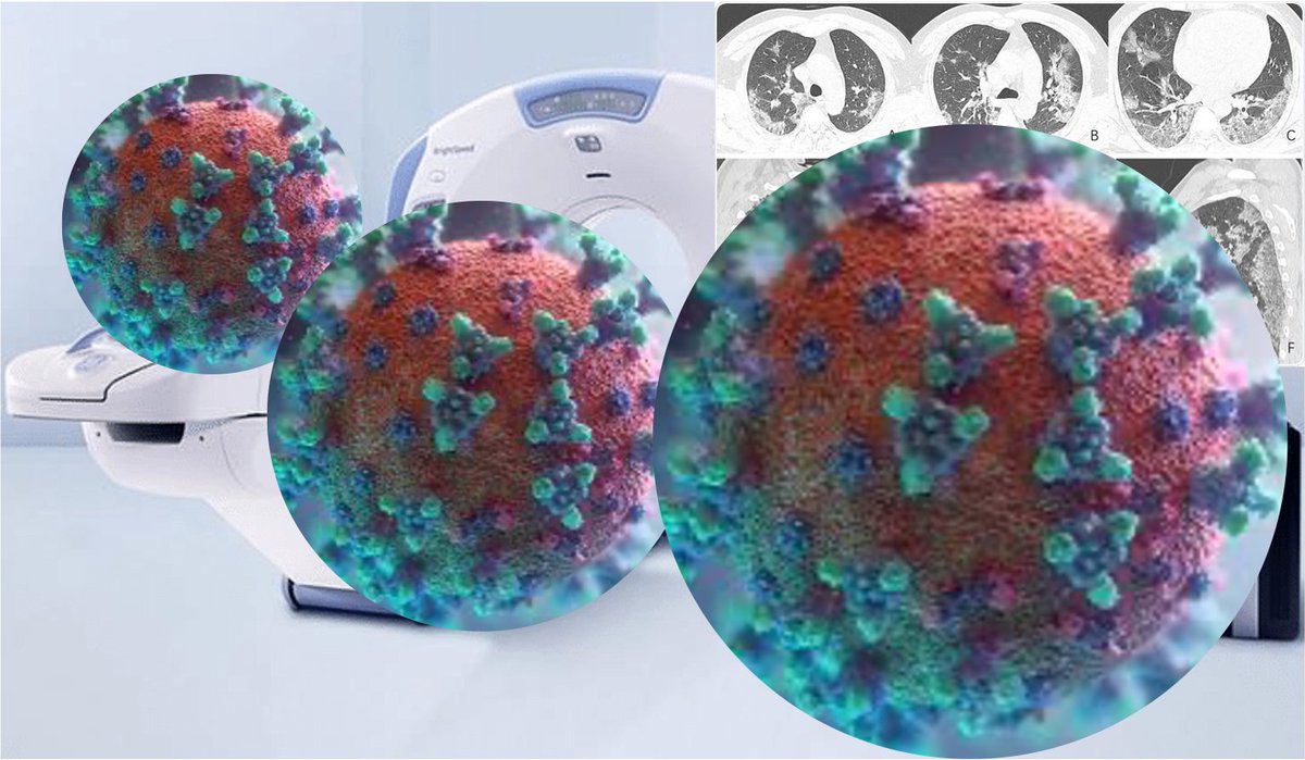 I wonder if Radiation from CT Scans and X Rays is fueling the emergence of SARS-CoV-2 mutants.

Should CT/X ray rooms require a thorough and validatable surface &amp; airborne disinfection each time they have a Covid-19 patient?

#COVID19 #medicalimaging #AcademicChatter #hypothesis