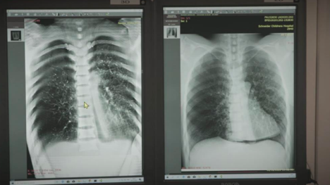  $NNOX value prop (2/4) -- better imagingMultiple X-ray sources (up to 11) allows for- more angles - more testsDigital approach enables- clearer imaging- less unnecessary radiation exposure -- comparatively limited Ma & KvP(ARC image on the left)