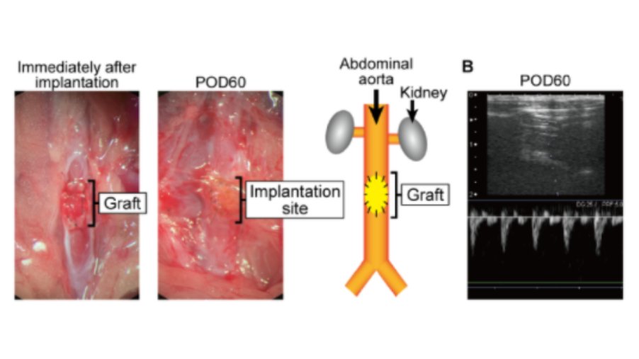 ArtifOrgans's tweet photo. #Scaffold‐free #Tissue‐engineered #ArterialGrafts derived from human #Skeletal #Myoblasts
#OnlineFirst👉https://t.co/7jl0wbtaCZ
@YCU_koho @osaka_univ_e @osaka_univ 🇯🇵
#TEVG #Arterial #Vascular #Grafts #ExtracellularMatrix #HydrostaticPressure #MechanicalStress #TissueEngineering https://t.co/SxPUjrydyn